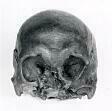 A Saxon skull dredged from the River Ant between Smallburgh and Stalham.  © Norfolk Museums & Archaeology Service