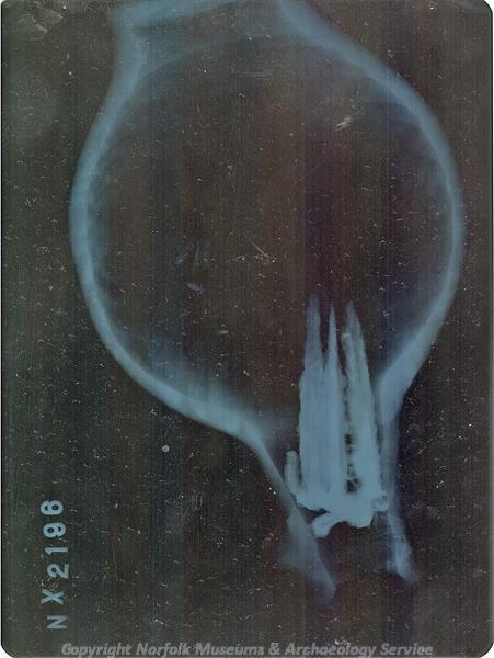 X-ray of a witch bottle found in Earsham.